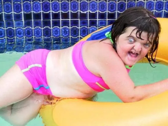 Down Syndrome Swimming Pool Girl 