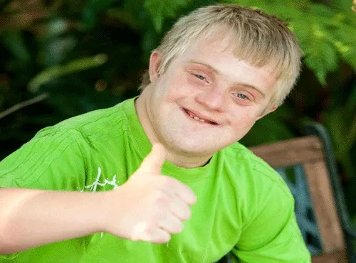 Downs syndrome thumbs up 
