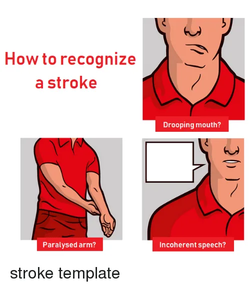 How to Recognize a Stroke 