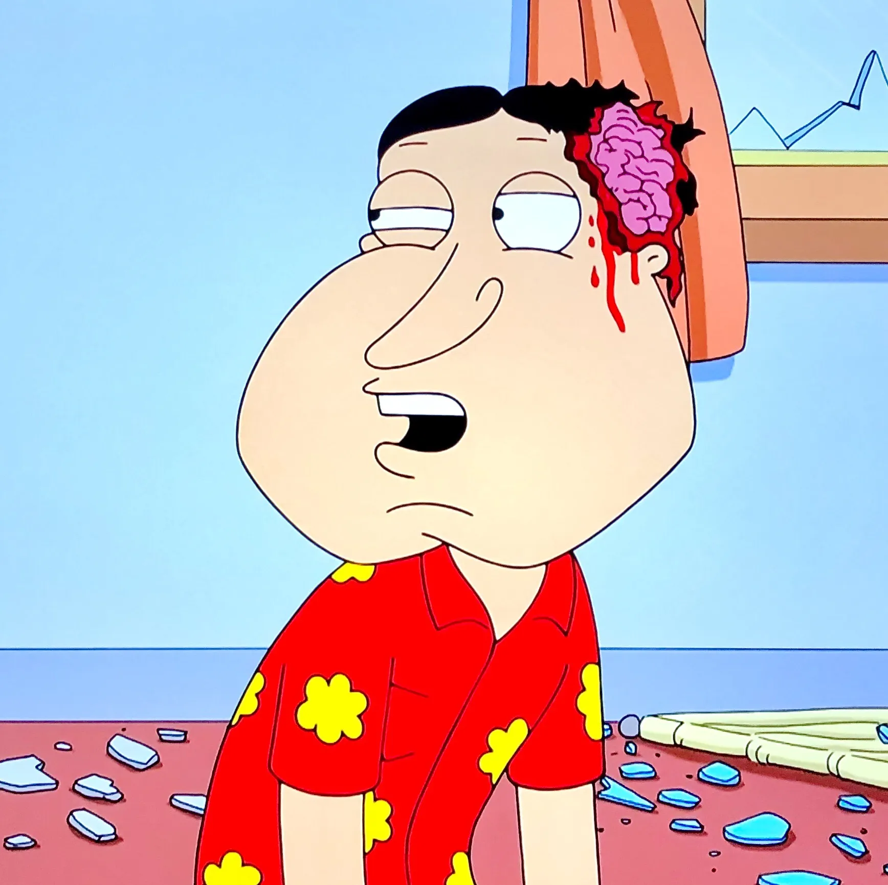 Massive Head Wound 