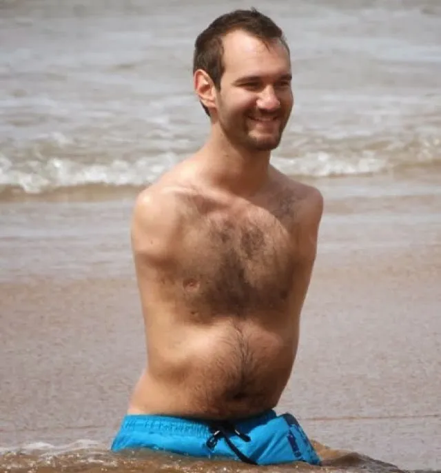 No Arms, No Legs Guy 