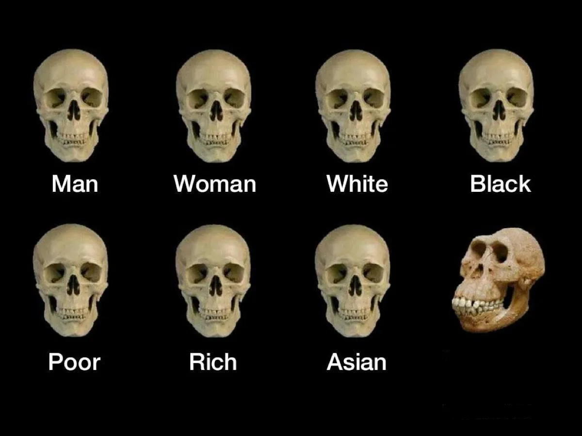 Skull idiot 