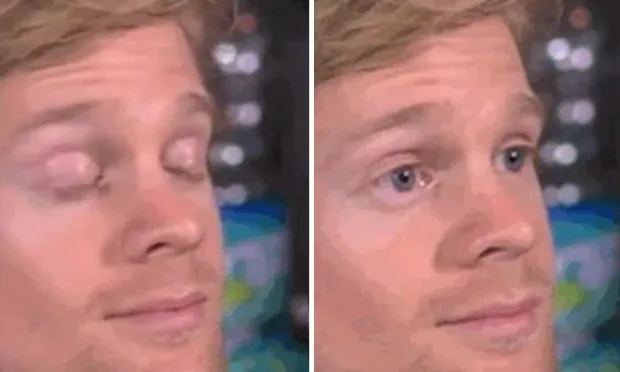 White guy blinking 