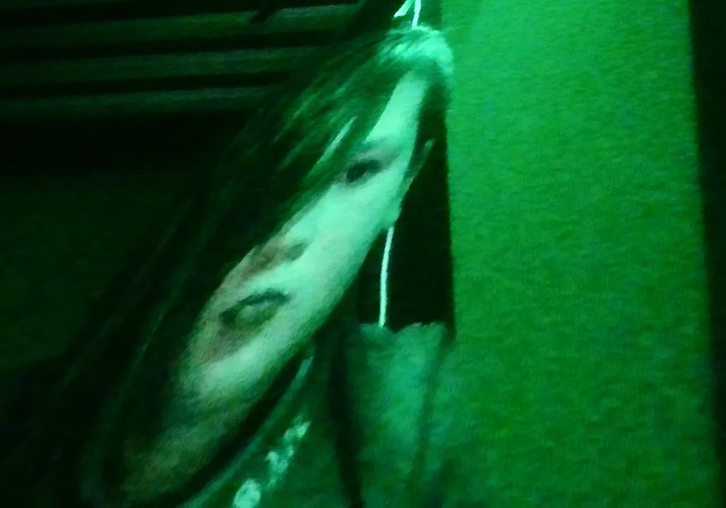 are you serious ringt now bro 