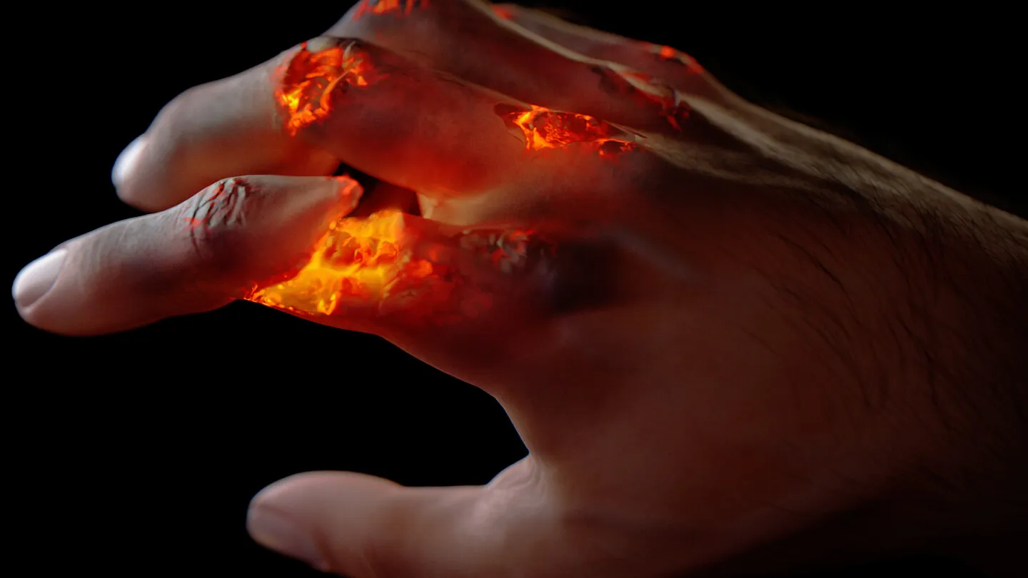 burning hand 